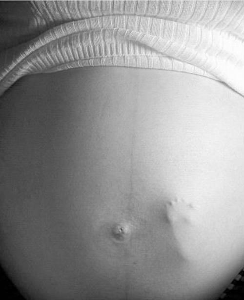 10 Babyfussabdruck im Mutterbauch